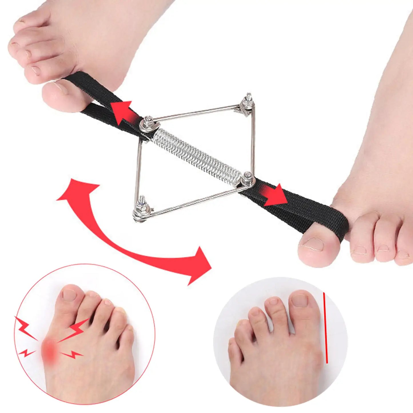 Bunion Corrector Elastic Toe Straightener