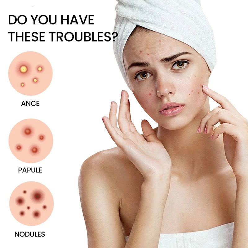 200Pcs Acne Pimple Patch Sticker Waterproof Acne Treatment Pimple Remover Tool Blemish Spot Facial Mask SkinCare Hidden Pimple