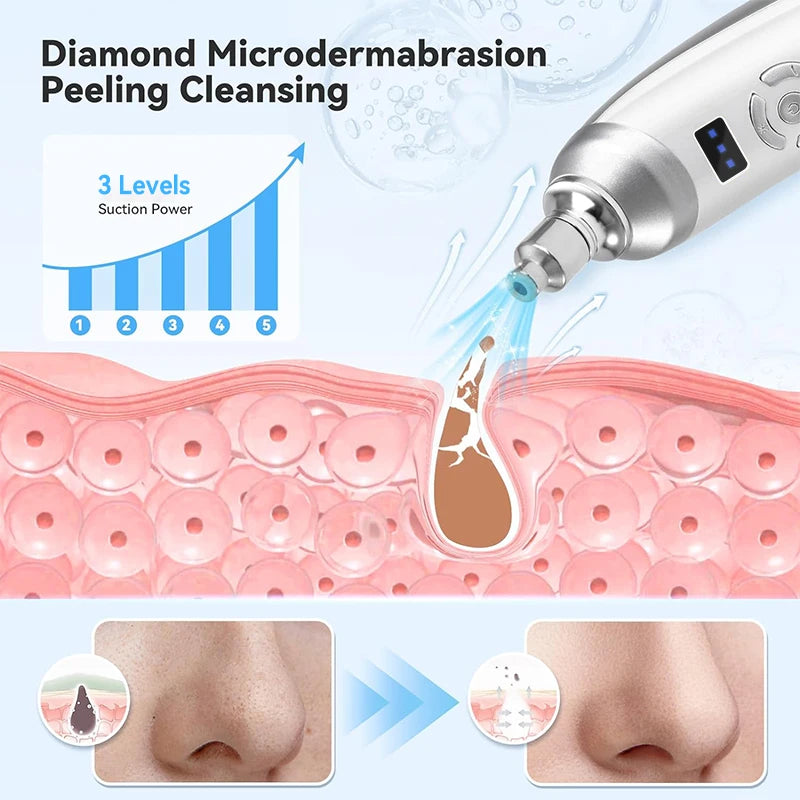 Portable Diamond Microdermabrasion Machine Handheld Blackhead Removal